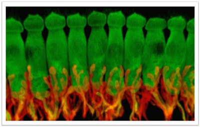 Cellen in ons binnenoor (hier in het groen). Als er iets niet goed zit in dit kleine deel van ons lichaam zijn de gevolgen voor het gehoor groot.
