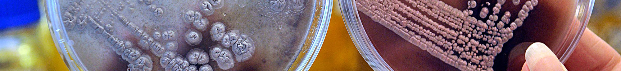 master thesis molecular biology Emphasis in bioinformatics the emphasis in bioinformatics is a degree option with specific requirements this degree option trains students in the fundamental principles of bioinformatics and prepares them for careers in research, medical and corporate settings. master thesis molecular biology Emphasis in bioinformatics the emphasis in bioinformatics is a degree option with specific requirements this degree option trains students in the fundamental principles of bioinformatics and prepares them for careers in research, medical and corporate settings.