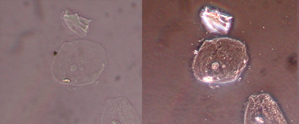 The same cells imaged with traditional bright field microscopy (left) and with phase contrast microscopy (right).