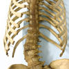 Spinal column with scoliosis