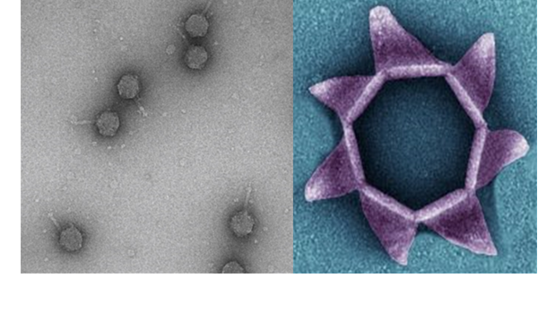 Transmission Electron Micrographs of archaeal virus structures. Left panel: Virus particles of the tailed halophilic virus HFTV1. Right panel: opened pyramidal egress structure used by the crenarchaeal virus SIRV2.