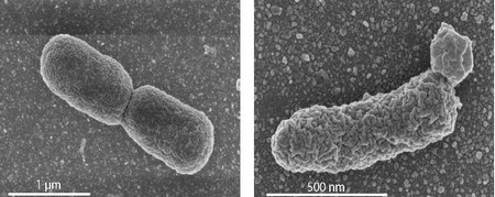 In the left panel: EM image of a normal dividing E. coli cell. Right panel: an engineered cell with high archaeal lipid production, showing lobular irregularities in the cell membrane. | Photo's University of Wageningen / Van der Oost laboratory
