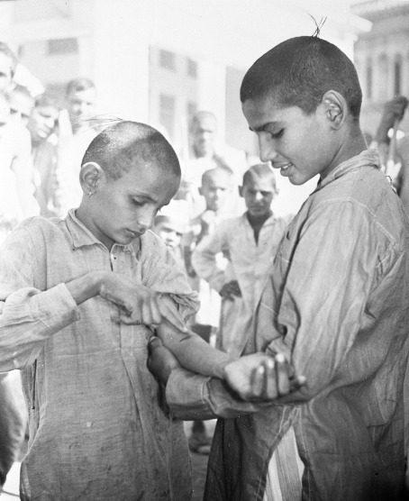 kinderen in India vergelijken de uitslag van hun tuberculose test