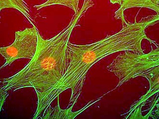 Cytoskelet in cellen zichtbaar gemaakt.