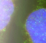 Medical Oncology