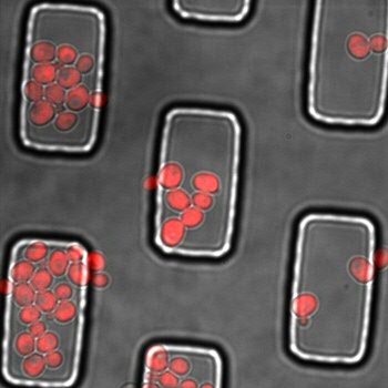In deze foto is het signaal van het fluorescerend eiwit dat de cellen geproduceerd hebben over de foto van de cellen geplaatst (dit zijn de rode stippen).