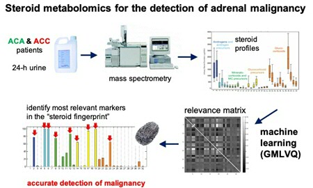 Metabolites of steroid hormones are measured in urine, and machine learning is used to detect patterns in the profiles. This allows differential diagnosis of benign and malignant tumours.