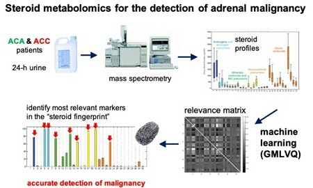 Afbraakproducten van hormonen zijn gemeten in urine, waarna kunstmatige intelligentie patronen opspoort in de profielen. Daaruit is te bepalen of een gezwel in de bijnier goedaardig of kwaadaardig is.