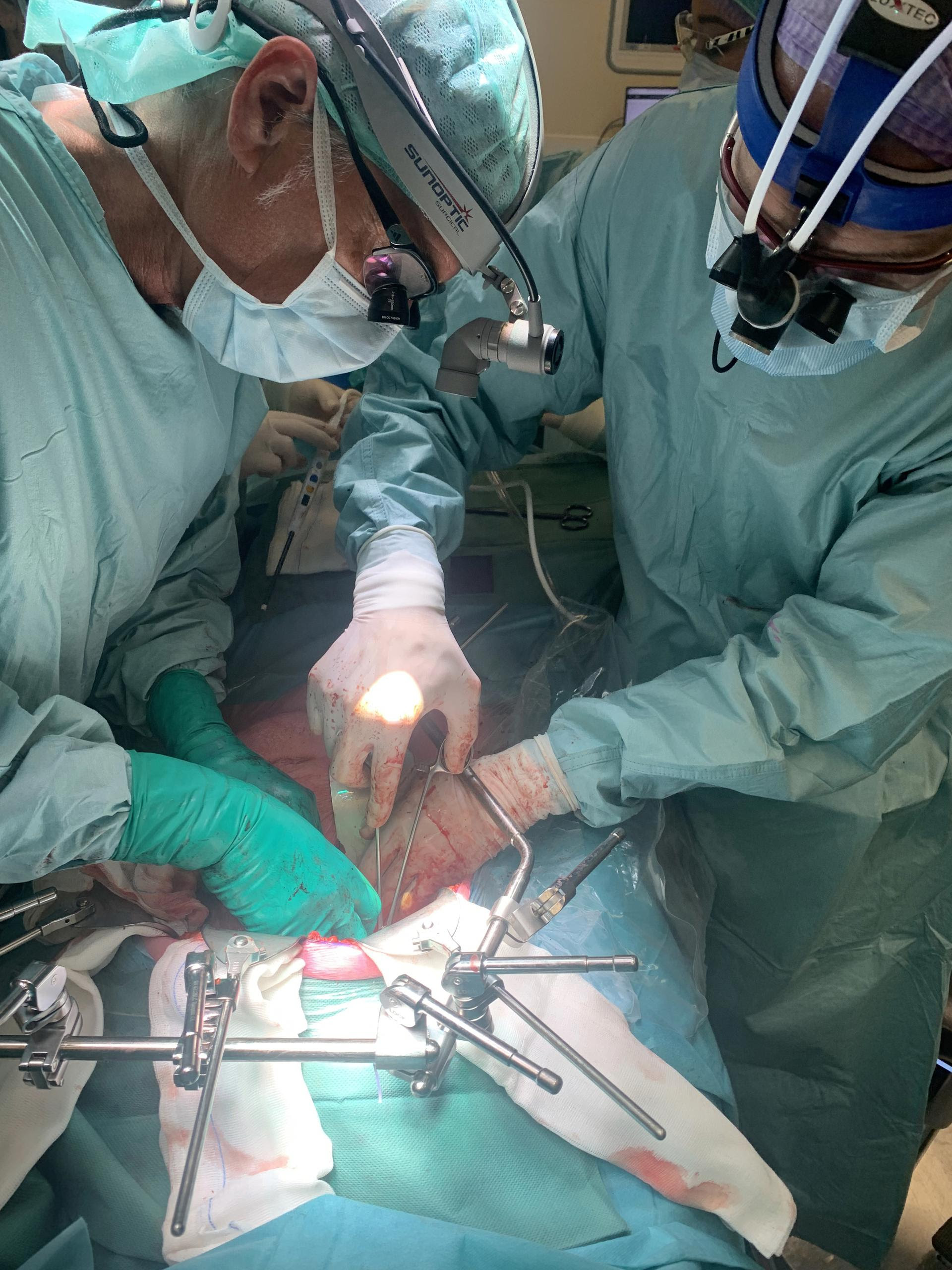 Een groot team van hartchirurgen, leverchirurgen en andere specialisten voerde de unieke transplantatie, die in totaal bijna 24 uur duurde, uit.