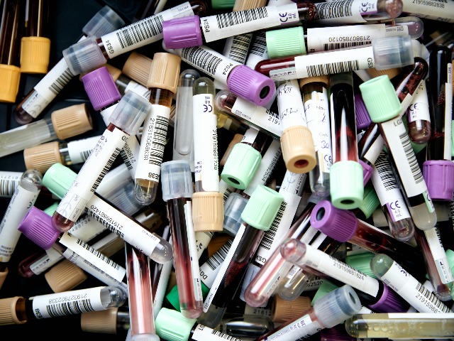 Blood samples
