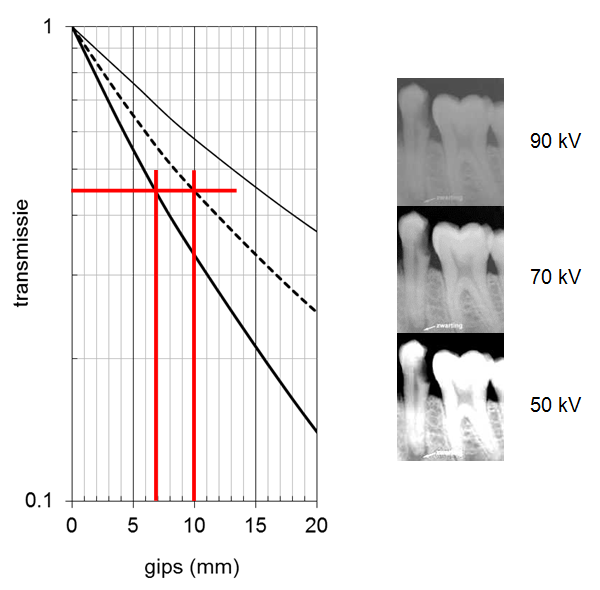 transmission through plaster for different values of the tube voltage