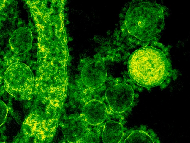 AI-toepassingen moeten vooral ondersteunend zijn.