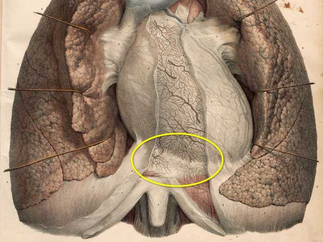 An anatomical drawing, showing the connection of the pericardium to the diaphragm