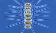 Voorbeeld van een mariene microalg: de veel voorkomende kiezelalg Chaetoceros sp.