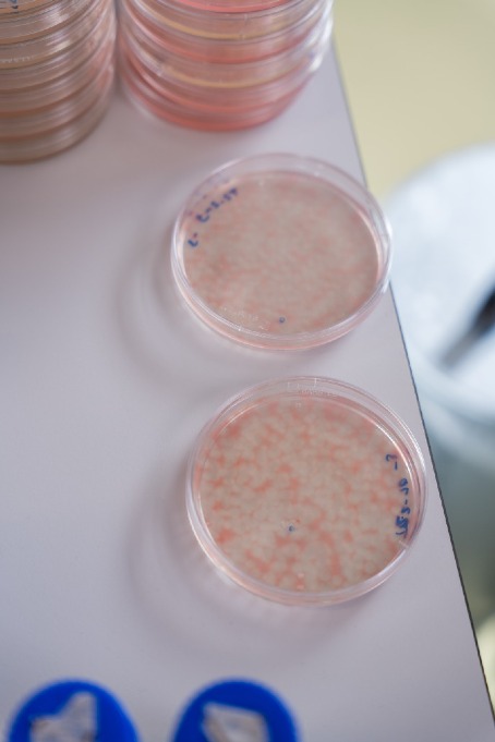 Archaea in een kweekbakje