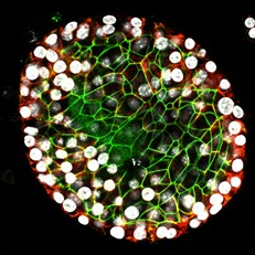 organoïde