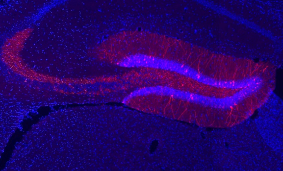 In this image (generated by Youri Bolsius), you see a subpopulation of brain cells that is part of a neural ensemble encoding a specific memory. This ensemble can be made light-sensitive and reactivated at any given time using intracranial laser stimulation (i.e. optogenetics) and make animals remember the encoded information. Using this approach, the researchers recently showed that sleep deprivation does not lead to memory loss, but rather disrupts the access to information stored under such suboptimal conditions.