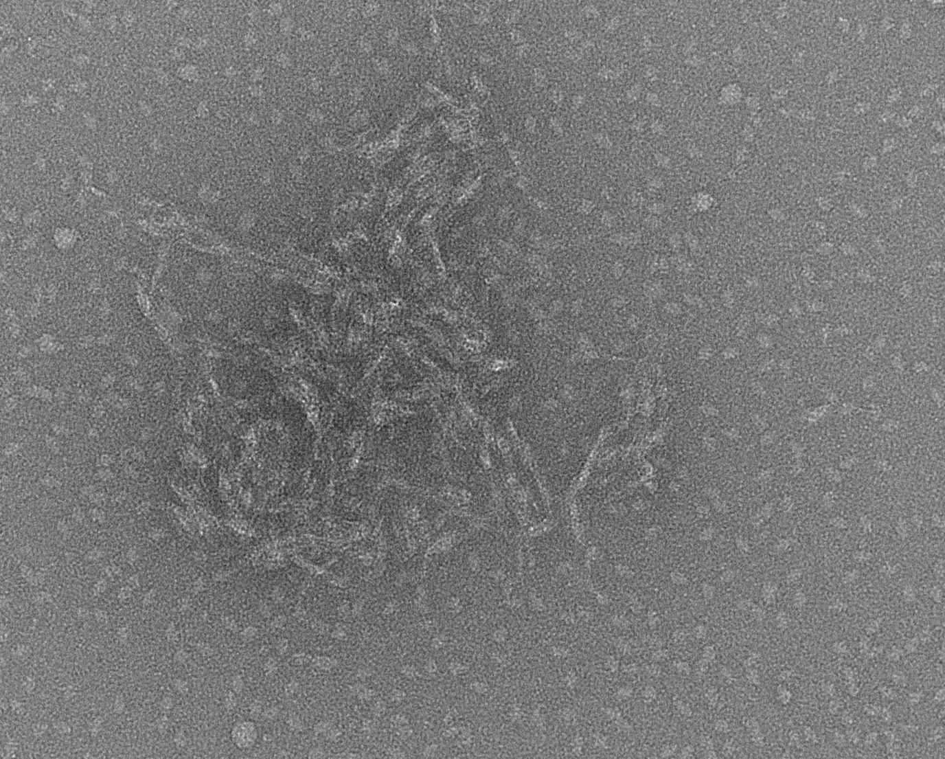 Eiwticlusters onder de elektronenmicroscoop