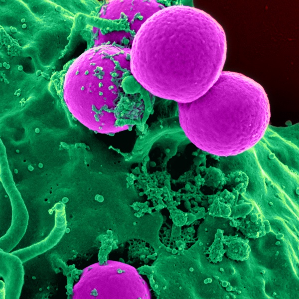 Weg met de resistentie: nieuwe manieren om infecties te bestrijden