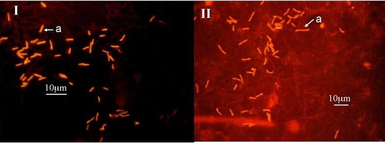 Microscopisch beeld van gekleurde E. Coli bacteriën