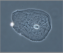 Fasecontrastbeeld van een cel uit het wangslijmvlies