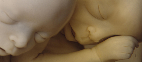 Foetus van een tweeling van 7 maanden, collectie Petrus CamperAnatomical preparation of a 7 months old fetus of twins, collection of Petrus Camper