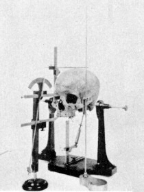 Craniometry (skull measuring)