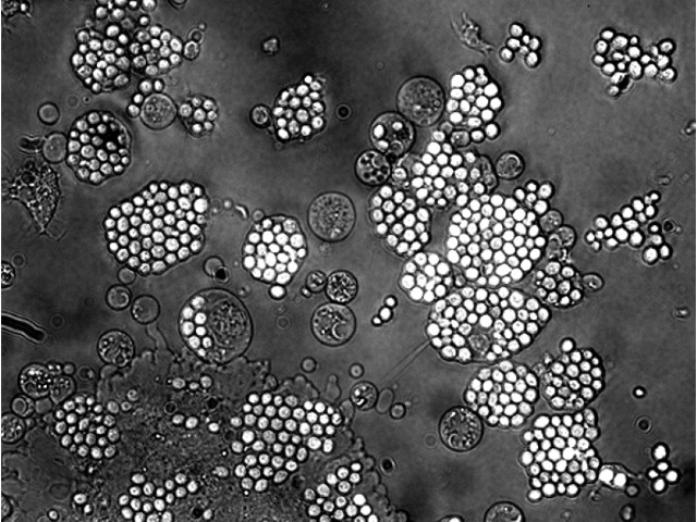 States&rsquo; Resilience to Future Health Emergencies &ndash; Connecting the Dots between Core Obligations and Core Capacities