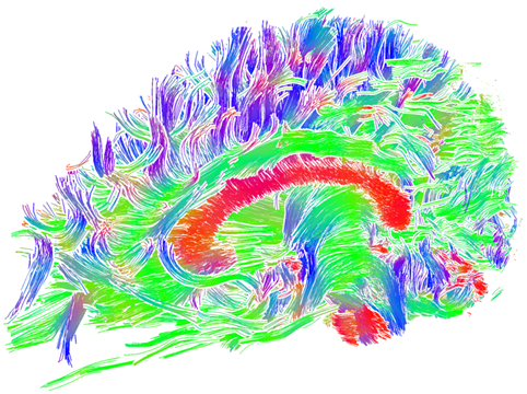 Illustrative rendering of line data using depth-dependent halos (M.H. Everts, H. Bekker, J. Roerdink, T. Isenberg).