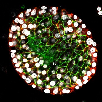 Image of a lung organoid