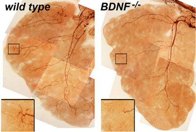 Neuronal remodeling