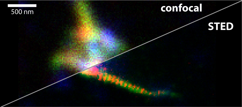 Comparison of confocal microscopy with STED