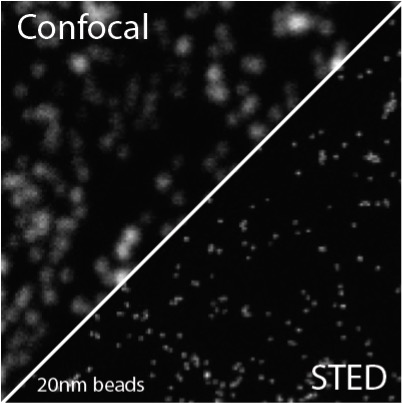 Confocal vs STED imaging