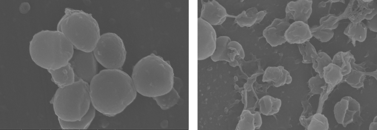 Scanning electron microscopy image of S. Epidermidis on titanium (left image) or coated titanium (right image)