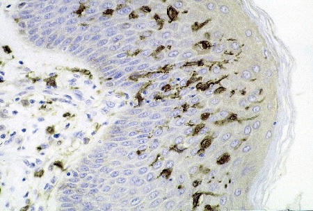 Section of skin showing large numbers of dendritic cells in the epidermis | Image Haymanj, Wikimedia, Public Domain