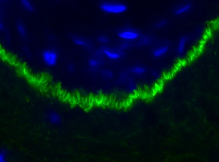 The U-shaped pattern (in green) visible in the skin biopsy of an EBA patient | Image UMCG/UoG.