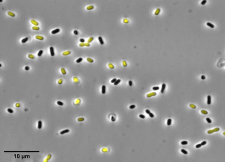 Acid (yellow) and normal cells