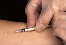 De Mantoux test