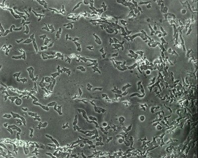 Dictyostelium cells Photo Ineke Keizer