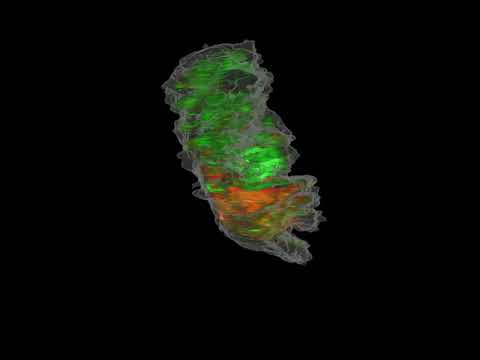 Example of a 3D optical image of an intact biopsy